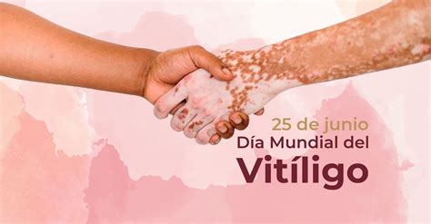 dia de muertos freepik|Día Mundial del Vitiligo: cuatro claves sobre esta  .